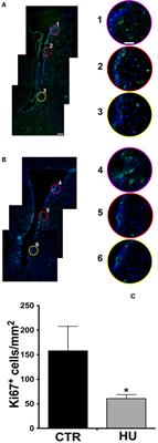 Reduction of Movement in Neurological Diseases: Effects on Neural Stem Cells Characteristics